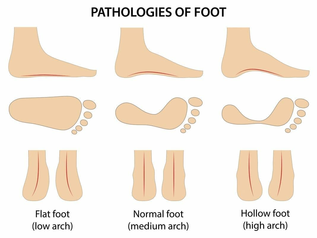 The ultimate guide to Hiking shoes | Rockchuck Summit