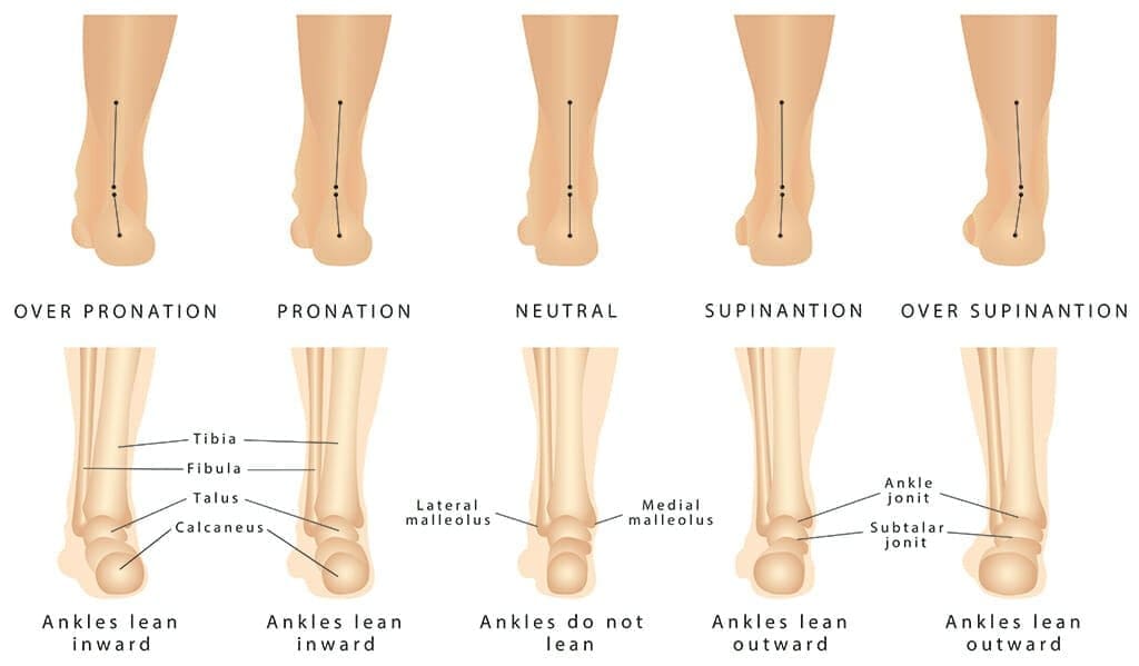 Foot Pronation for fitting hiking shoes